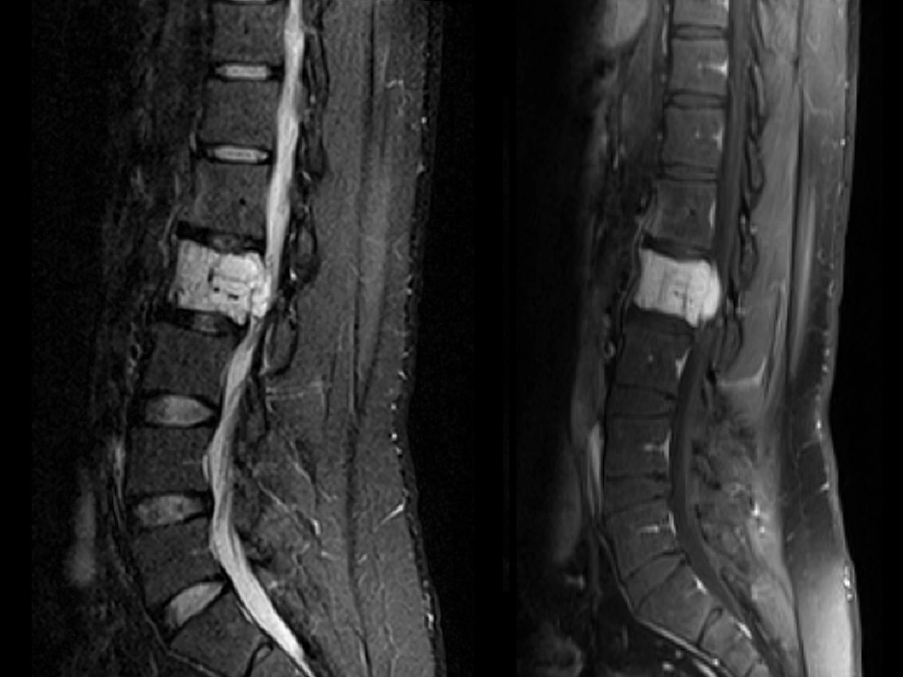 Medical scan from Hemangiomas project